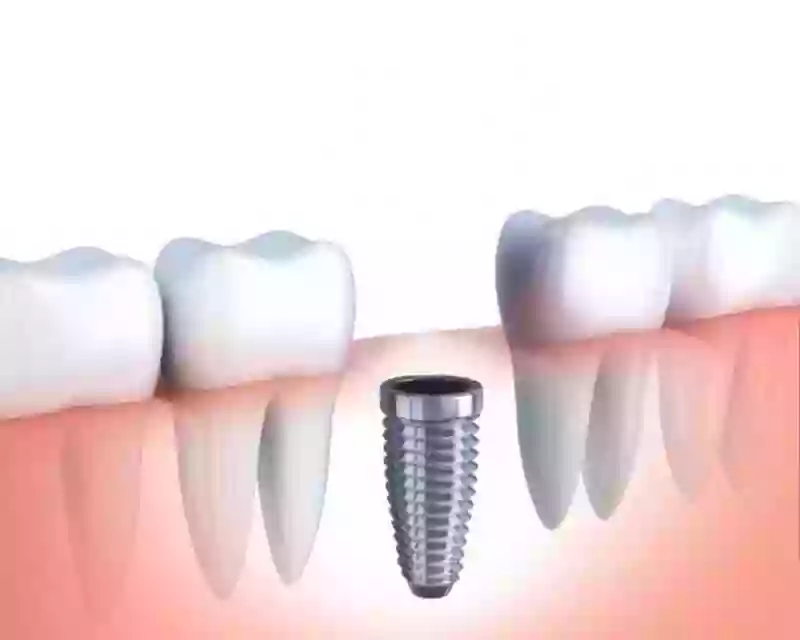 Dental Carpe Dental Carpe