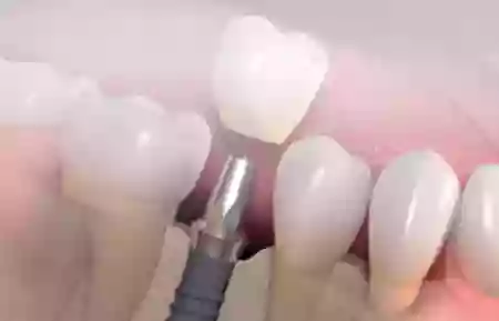 Dental Arts Dental Arts