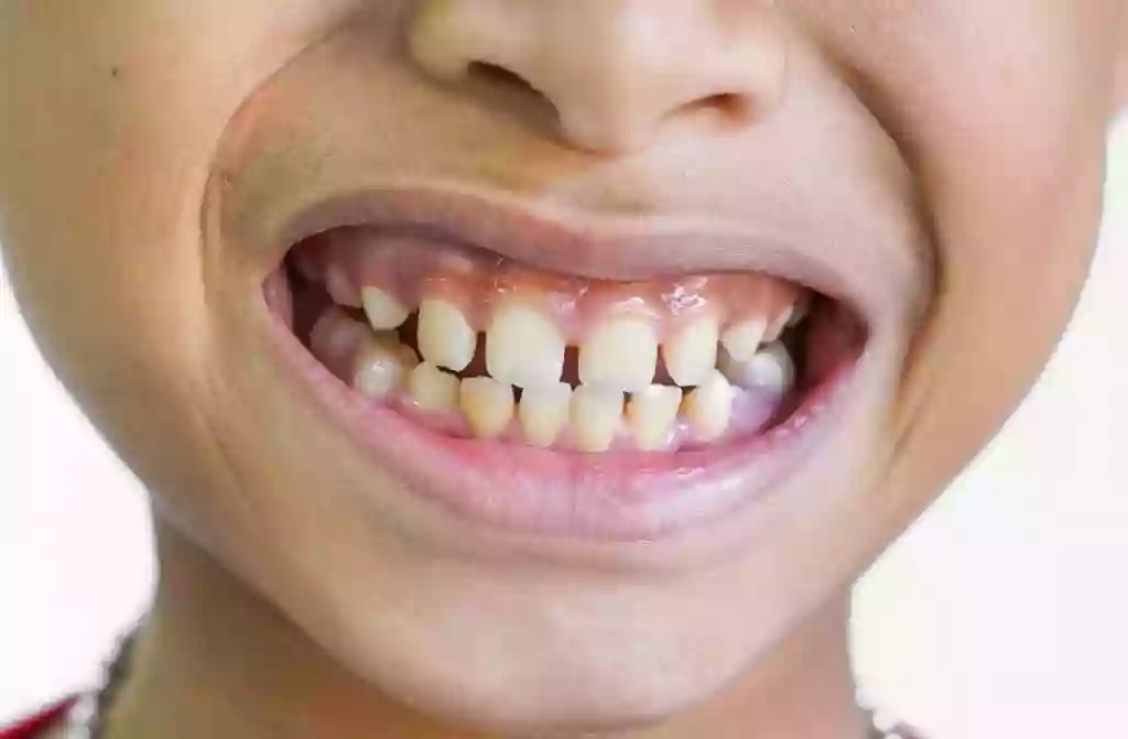 Fresh Dental Fresh Dental