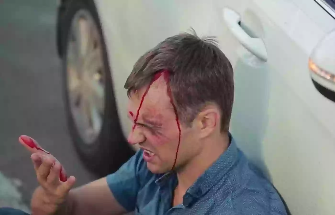 Traumatic Brain Injury Traumatic Brain Injury