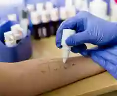 Direct Allergy Direct Allergy