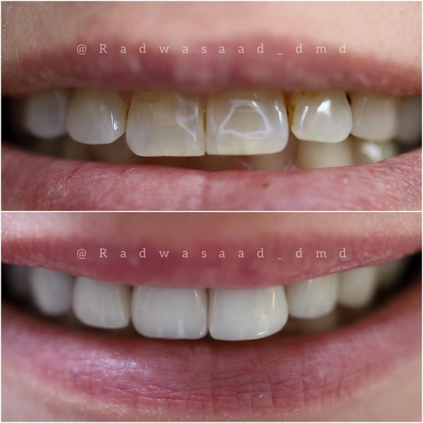 Photo of Dent Blanche Dental - 3640 Lawrenceville Road, Princeton, NJ 08540